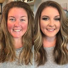 Best coverage for Rosacea