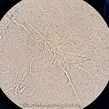 Image result for Kohautia microflora