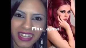 شاهد صور قبل وبعد عمليات التجميل الجراحية وغير الجراحية في ايران. Ù‚Ø¨Ù„ ÙˆØ¨Ø¹Ø¯ Ø¹Ù…Ù„ÙŠØ§Øª Ø§Ù„ØªØ¬Ù…ÙŠÙ„ Youtube