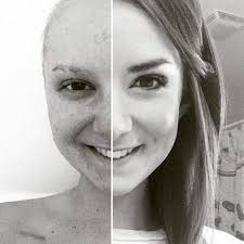 Welcome to Christy Davis' MWOY Fundraising Page!