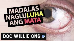 Untuk masalah sakit mata pada hewan biasanya akan diberikan antibiotic dalam bentuk obat tetes mata agar memudahkan kita untuk mengaplikasikannya. Madalas Nag Luluha Ang Mata Ni Doc Yul Dorotheo Eye Doctor 2b Youtube