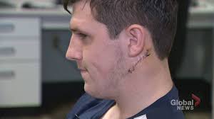 Nova Scotia hockey player escapes potentially life-threatening neck injury 