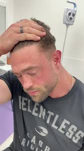 Achieving the Perfect Body: A Journey to Fitness and Hairline Transformation