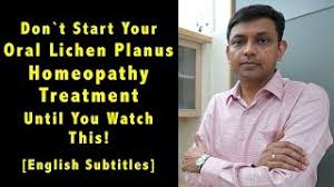 Don T Start Your Oral Mouth Lichen Planus Homeopathy Treatment Until You Watch This Home Remedies Youtube