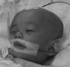 Seorang bayi perempuan berusia sembilan bulan meninggal dunia di bandar baru bangi setelah dipercayai didera oleh suami kepada pengasuhnya sendiri. Bayi 9 Bulan Maut Akibat Pendarahan Serius Di Kepala Disyaki Dera Bumbumcak My