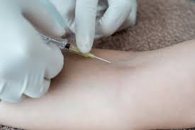 Image result for Hand Injection