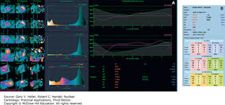 Image result for Nuclear Ventriculogram