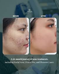 Tosca Aesthetic Clinic (@toscaclinic) • Instagram photos and videos