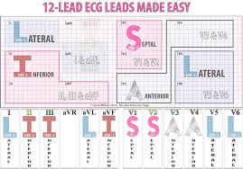 12 Lead Ecg Localization Of Ischemia Infarction Icu Nursing Cardiology Nursing Cardiac Nursing
