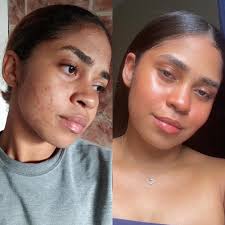 Gema Herrera ( la piel ) (@loscambiosdegema) • Instagram photos and videos