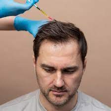 PRP In Dubai For Hair Loss | PRP Treatment in Dubai | Hair Fall
