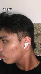 Kyla's Stunning Transformation with Vitabears