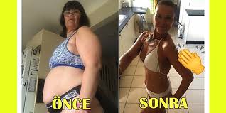 Hiçbir şey yemiyorum ama bir türlü kilo veremiyorum diyorsanız ya yanlış yöntemler deniyorsunuz ya da bilmediğiniz bir sağlık probleminiz var. Pes Etmek Yok Bicak Altina Yatmadan Ve Spor Yapmadan 3 Ayda 31 5 Kilo Veren Ana Reyes In Hikayesi Onedio Com