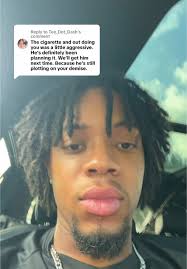 Darius The Voice Talks about New Teeth