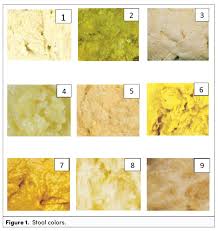 Image result for acholic stools human