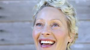 EXCLUSIV. Când Zâmbesc, Mi Se Vede Gingia într-un Mod Inestetic. Există  Corecţie Pentru Acest Neajuns? Esteticianul Adina Alberts Răspunde