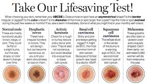 How To Be Smarter About Skin Cancer Glamour