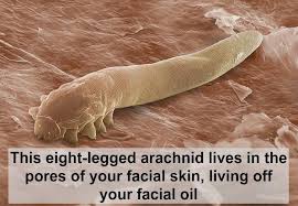 Bird Mites In Hair Rosacea May Be Caused By Mite Faeces In Your Pores Demodex Facial Skin Skin Pores
