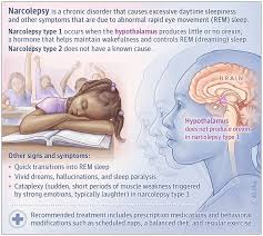 Image result for Narcolepsy