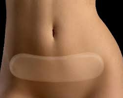 Leaking of digestive juices and partially digested food through an anastomosis is one of the most serious complications after bypass surgery. Silicone Strips Do They Help Surgery Scars Coco Ruby Plastic Surgery