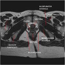 Check spelling or type a new query. Mri And Us Anatomy Of Female And Male Pelvic Floor Semantic Scholar