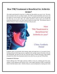 Facebook gives people the power to. Chinoaestheticdental Publisher Publications Issuu