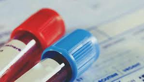 This page covers tests that are often used to help diagnose cancer. Leukemia And Anemia What S The Link