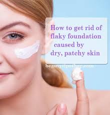 How To Get Rid Of Flaky Skin Dry Patches For Perfect Foundation Beauty And Makeup Tips Flaky Skin On Face Dry Flaky Skin Dry Skin Patches
