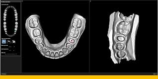 There are, however, presently multiple ways of filling the gaps thanks to advancements in dental technology. Bridging The Gap Between Restorative And Periodontal Dentistry
