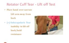 Image result for Lift-Off Subscapularis Test