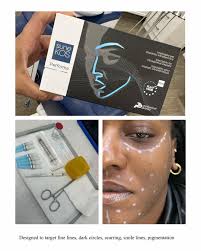 How Long Does It Take for Sunekos to Work