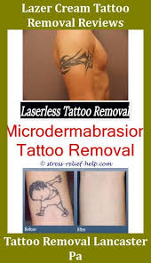 Pin On Tattoo Removal
