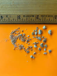 Collection Of Kidney Stones From My Past 3 Surgeries I Had A Laser Lithotripsy And The Stones They Extracted Are Not In This Picture But Here S How My Last Couple Months Have