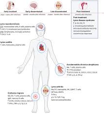 Image result for Lyme Carditis