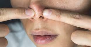 Image result for skin cancer on nose pimple