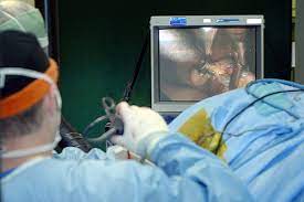 Gradinaru aurora la abordul laparoscopic pentru hernia ombilicala. Ce Inseamna Chirurgia Fara Cusaturi Medlife