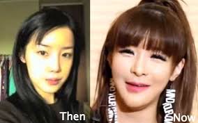 why did park bom ruin her face