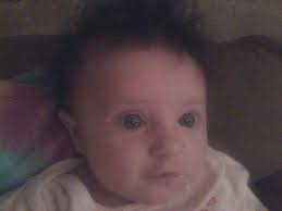 Do schizencephaly kids can live normal and healthy life . .