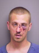 Car chase suspect spits blood and bites nurse, deputies say