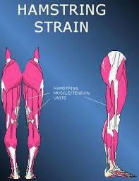Pin On Pain Back Of Knee