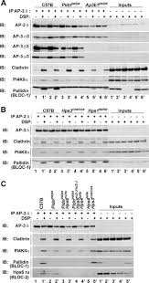 17:07 traian băsescu este aproape de pușcărie: Hermansky Pudlak Syndrome Protein Complexes Associate With Phosphatidylinositol 4 Kinase Type Ii A In Neuronal And Non Neuronal Cells Sciencedirect