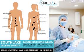Check spelling or type a new query. When Do I Need To Have Hernia Surgery Southlake General Surgery
