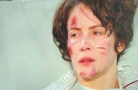 She Was brought Paralysed From Her Waist Down