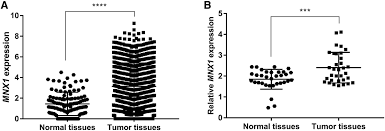 Facebook gives people the power to share and makes the world. Expression Clinical Significance And Functional Prediction Of Mnx1 In Breast Cancer Molecular Therapy Nucleic Acids