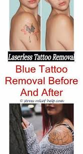 Tattoos that would need eight. Tattoo Cover Up Did The Impractical Jokers Get Their Tattoos Removed Does Tattoo Removal Scar Picosure L Cover Tattoo Skin Color Tattoos Laser Tattoo Removal