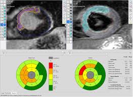Ct Scan Vs Mri Daic