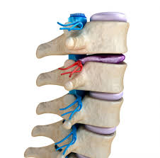 Bone spurs form naturally on the back of spine as a person ages and are a sign of degeneration in the spine. Degenerative Disc Disease Causes And Treatment