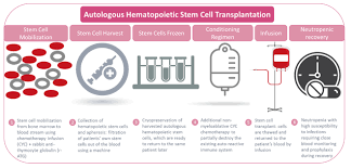 These include leukemia, lymphoma, and multiple myeloma. Autologous Stem Cell Therapy For Ms L Pharma Intelligence