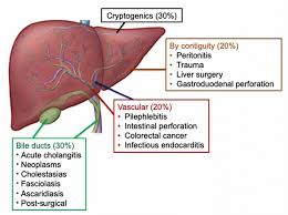 Image result for Liver Abscess