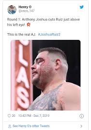 Still having the supports and everything. Anthony Joshua Beats Champion Andy Ruiz To Reclaim Heavyweight Belts Photos 36ng